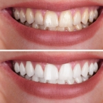 Sağlıklı Gülüşler İçin Modern Diş Çözümleri